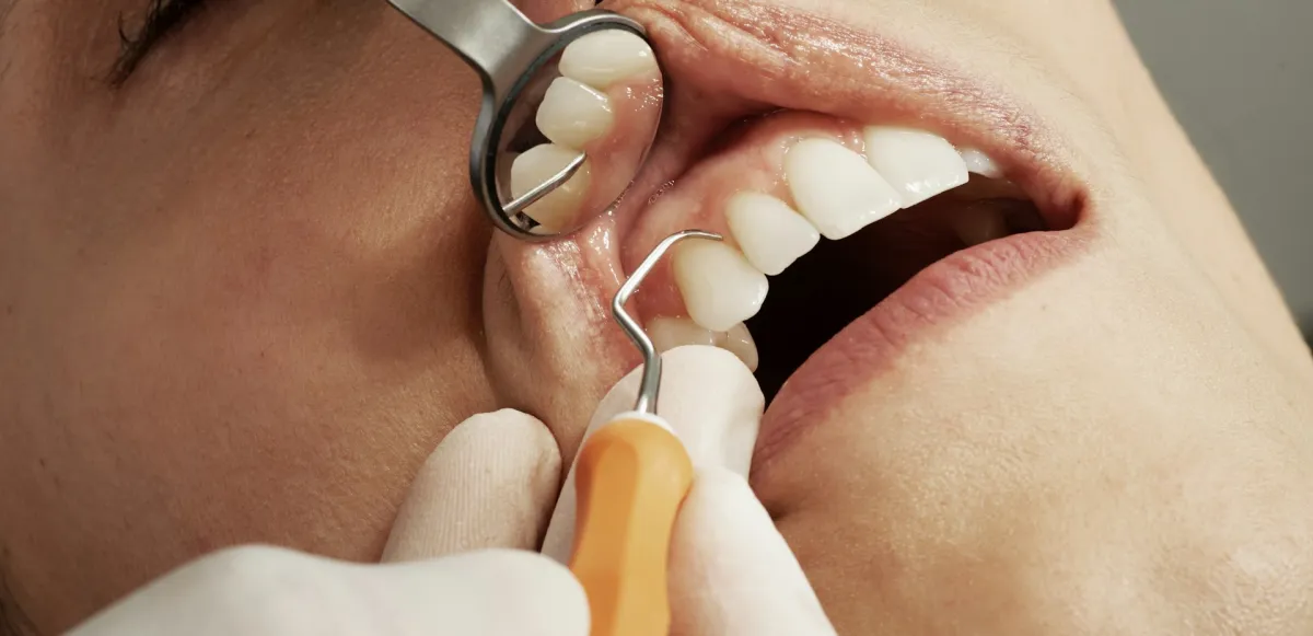 Atención odontológica durante una consulta