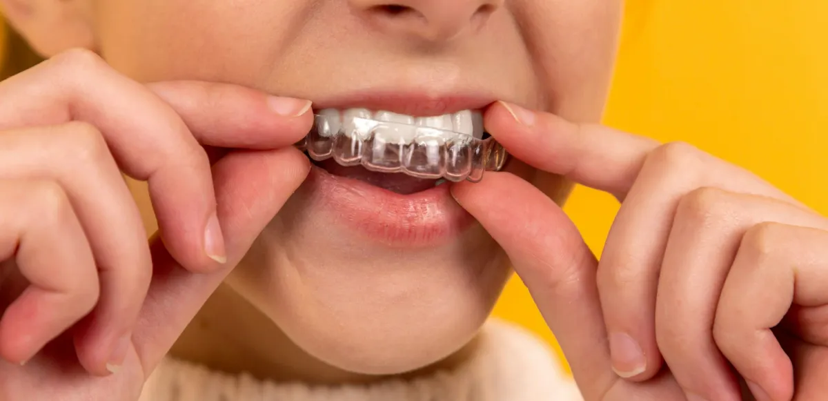 Revisión de la sonrisa y cuidado de los dientes