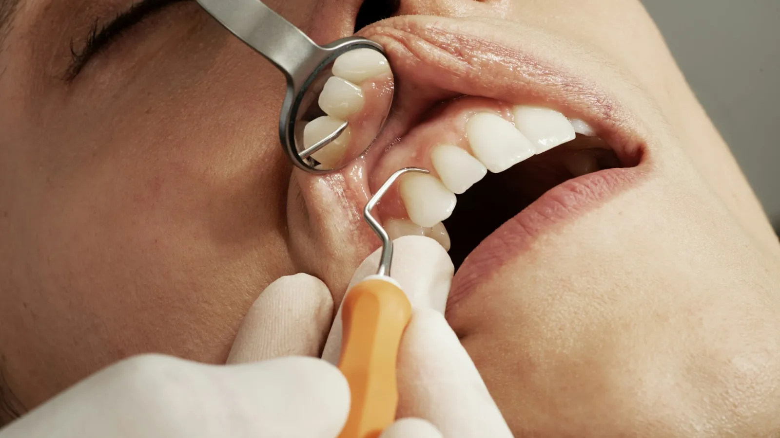 Atención odontológica durante una consulta