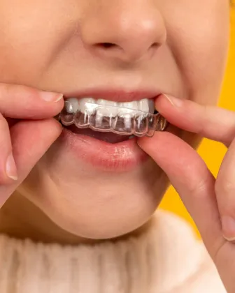 Revisión de la sonrisa y cuidado de los dientes