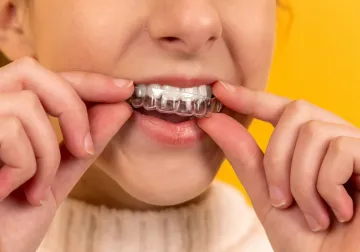 Revisión de la sonrisa y cuidado de los dientes