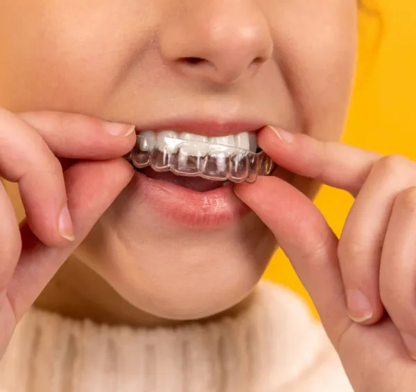 Revisión de la sonrisa y cuidado de los dientes
